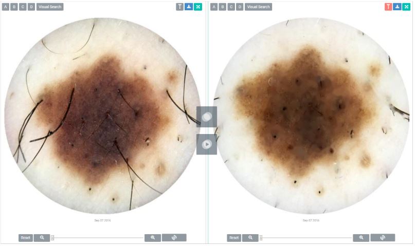 /media/news_images/2018/09/20/Dermengine_Dermatology_EMR_Software.JPG