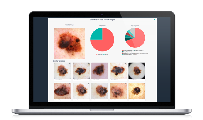 /media/news_images/2018/11/20/artificial-intelligence-for-dermatology-software.png