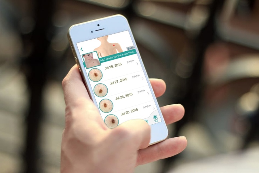 /media/news_images/2018/12/03/Patient_performing_skin_care_on_MoleScope_app.jpg