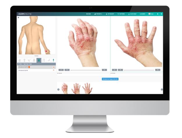 /media/news_images/2019/09/03/DermEngine_Dermatalogy_Software.JPG